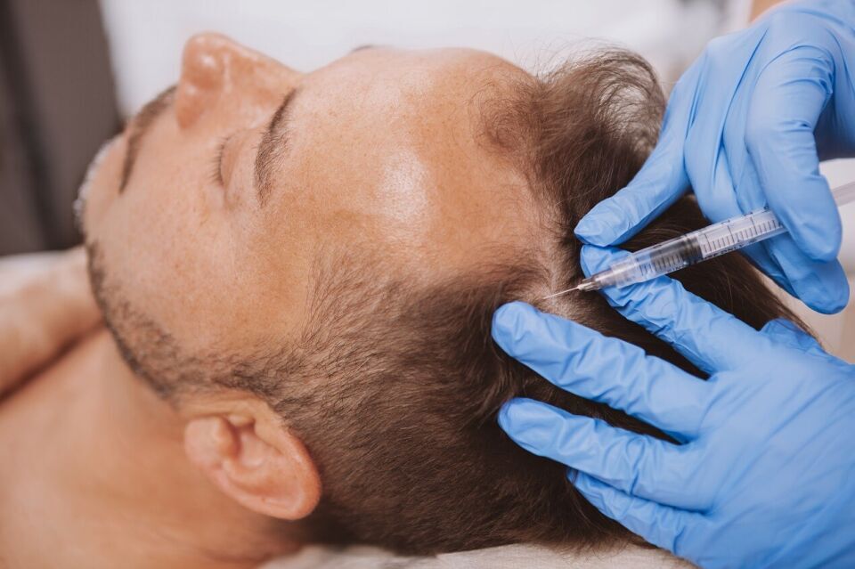 Skuteczne metody regeneracji włosów po chemioterapii