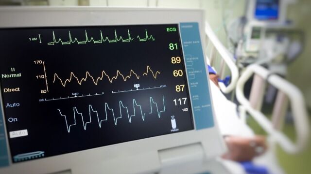 Sprzedaż nowoczesnych aparatów EKG online - gdzie warto kupić?